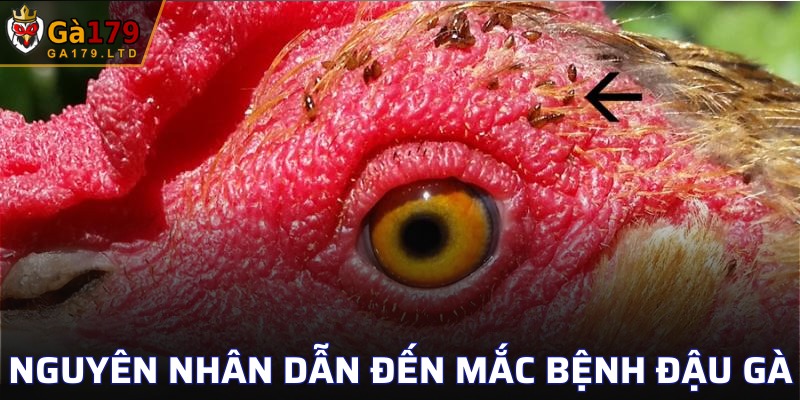 Lý do dẫn đến mắc bệnh liên quan về đậu gà