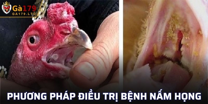 Các phương pháp điều trị bệnh nấm họng ở gà